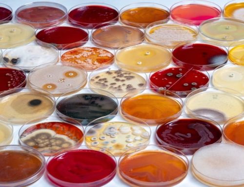 Microrganismos perjudiciales: cómo afectan industrias y qué hacer para prevenirlos