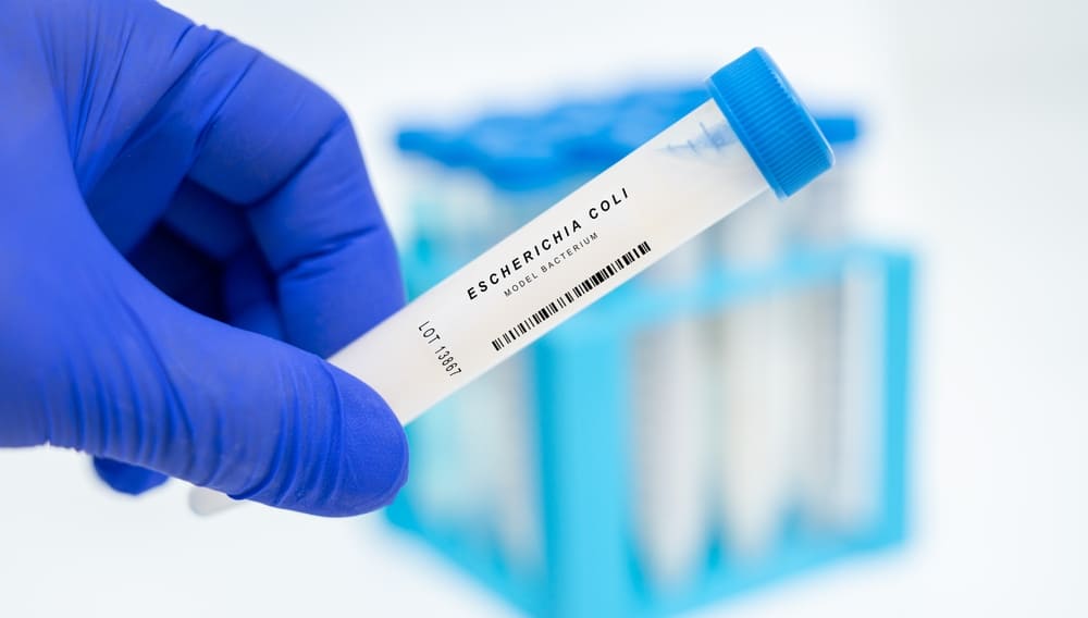 que es la bacteria escherichia coli